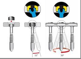 利用加壓螺帽將傳統螺釘轉換為多軸互鎖式螺釘之示意圖