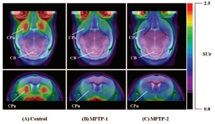 以正子斷層造影影像觀察實驗動物中使用18F-FP-(+)-DTBZ追蹤於神經毒劑MPTP